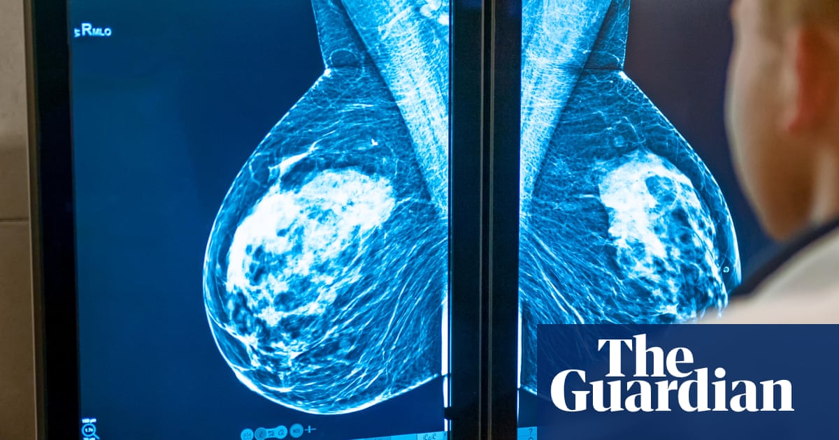 NHS gave private firms record 216m to examine X-rays in 2024