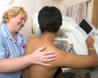 Ethnic minorities in England less likely to get breast cancer diagnosis from routine screening