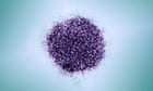 NHS testing initiative to eliminate hepatitis C in England by 2025