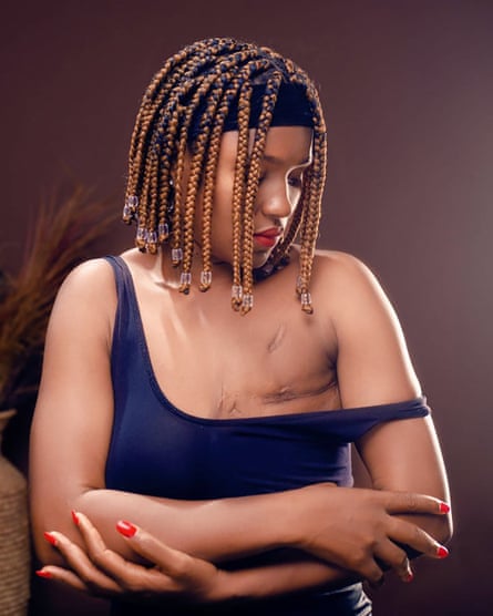 Gloria Chinyere Okwu wears a dress with one strap lowered to show her mastectomy scar