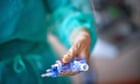 Elderly man has wrong leg amputated at Austrian clinic