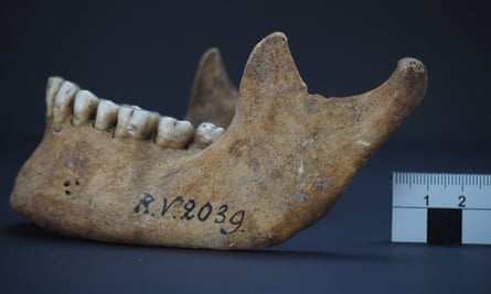 This image shows the jawbone of the man who was buried in Rinnukalns, Latvia, around 5,000 years ago.