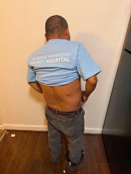 Man suffered brain injury and severe bruising after ICE arrest in Virginia, records show Man suffered brain injury and severe bruising after ICE arrest in Virginia, records show
