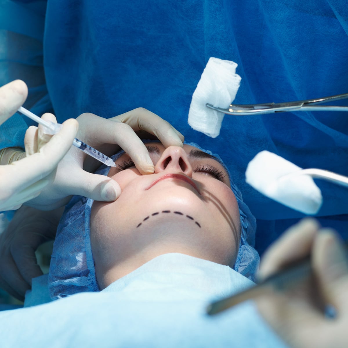 Expert Eyelid Plastic Surgeon of North Dallas - Cosmetic & Reconstructive Eyelid Surgeon Plano & North Dallas