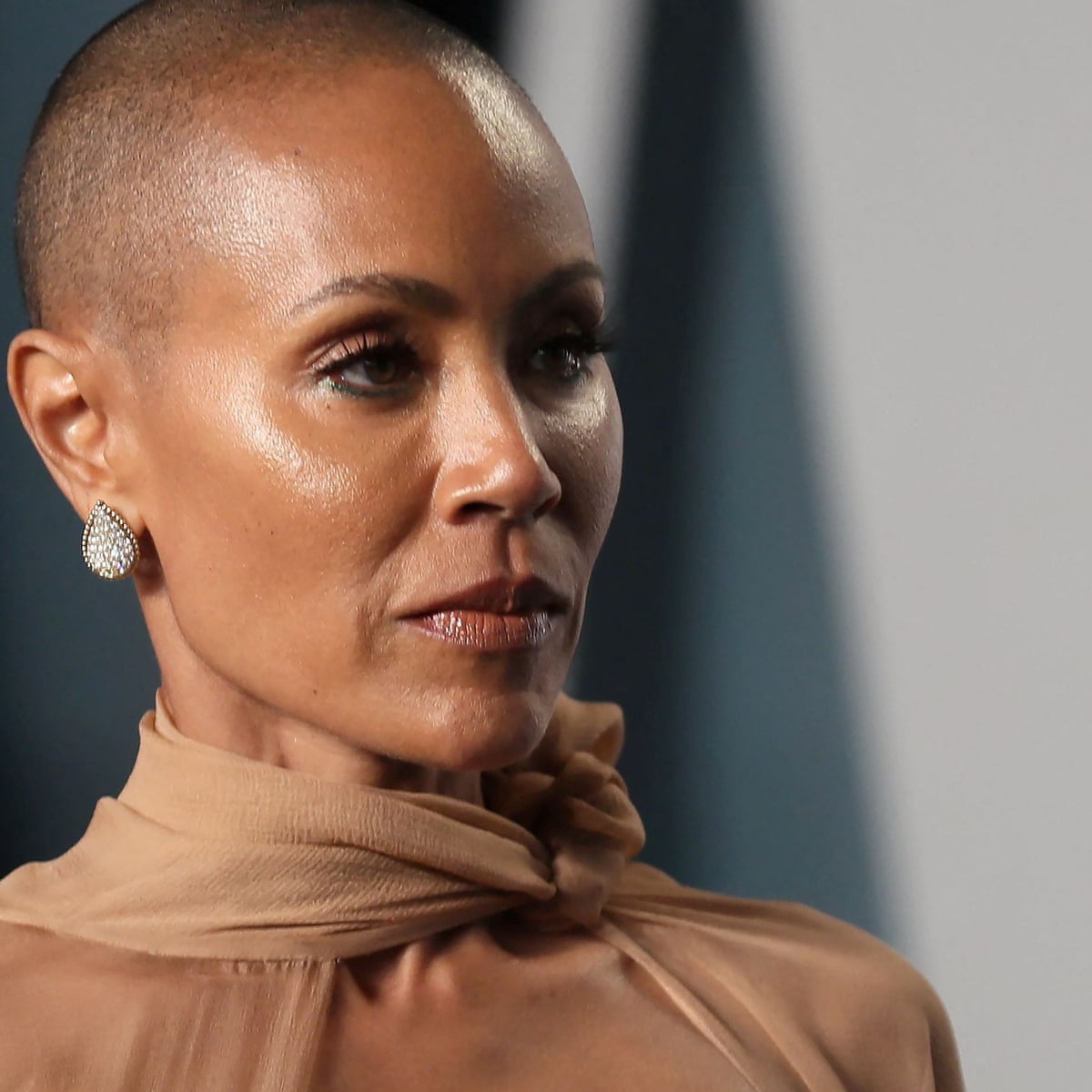 Jada pinkett smith alopecia