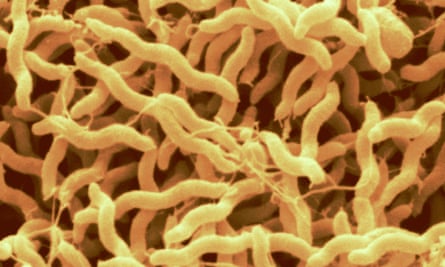 A colour enhanced scanning electron micrograph of the bacteria Campylobacter.
