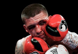 Lee Selby ensangrentado en su pelea con Omar Douglas en el O2 Arena de Londres el 23 de febrero.