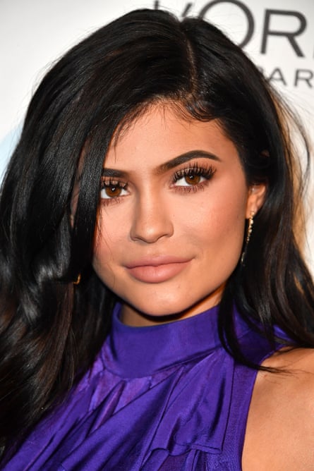 Kylie Jenner is famous for her lips, which have been filled.