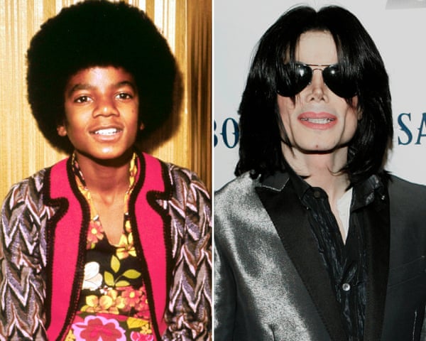 Left: a young Michael Jackson, Right: Michael Jackson after his cosmetic procedures.
