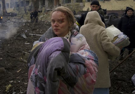 A woman stands outside a maternity hospital that was damaged by shelling in Mariupol.