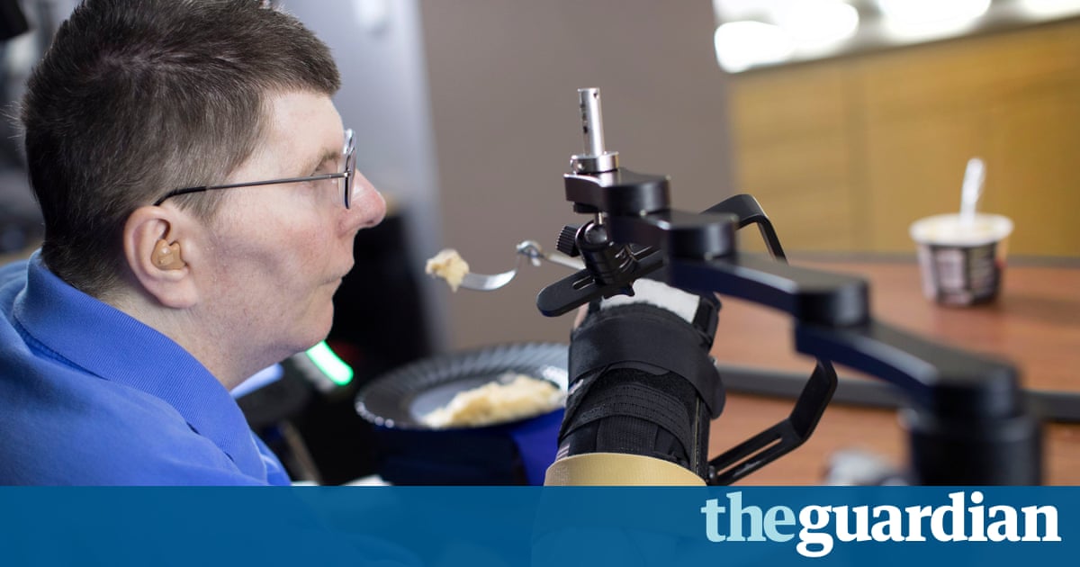Image result for New technology allows tetraplegic man to move hand with thought