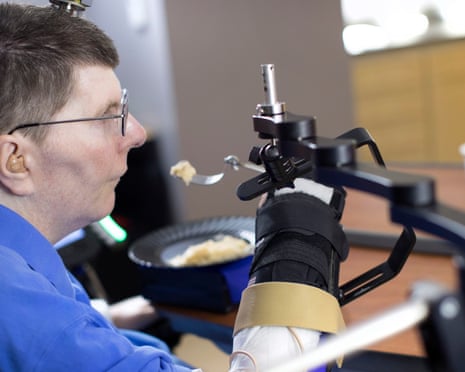 Bill Kochevar, who was paralysed eight years ago, but has regained some control of his arm thanks to neuroprosthetics.