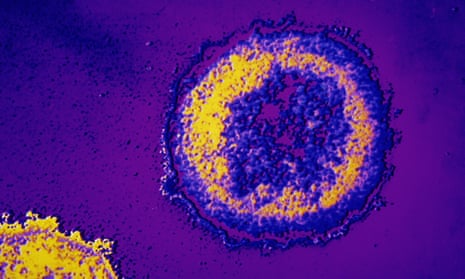 Microscopic HIV virus