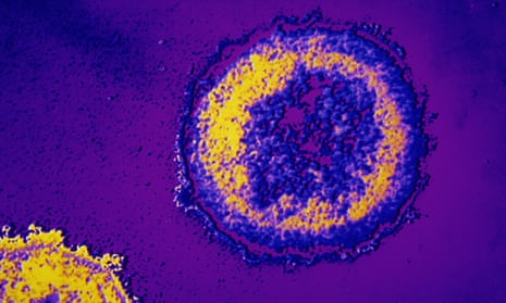 Microscopic HIV virus