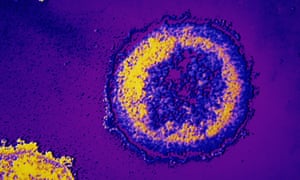 The HIV virus seen through a microscope. There are fears a reduction of services in London could see infection levels rise again.