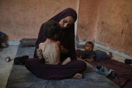 A woman with a painfully thin child in her lap