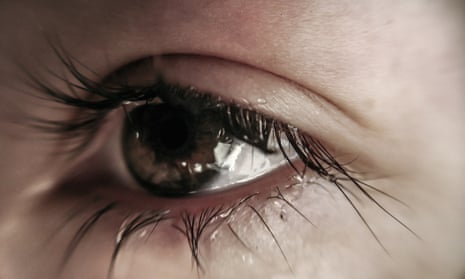 Different Types of Tears, Weep Eye
