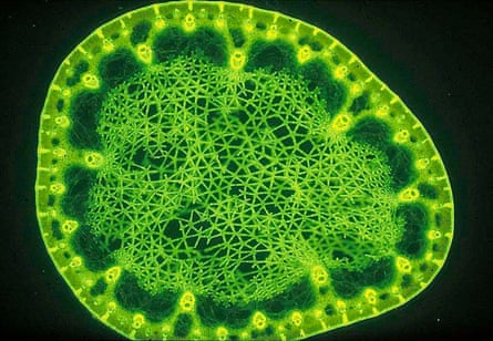 Section of a Juncus leaf, with Stellate parenchyma pith, under the microscope.