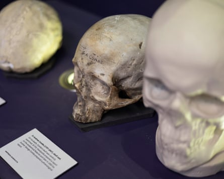 skulls and casts in a display case