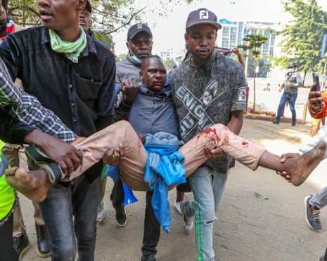 An injured demonstrator is carried to safety during a protest in the central business district in Nairobi, Kenya, 25 June 2025, marking the first anniversary of the Gen Z protests that culminated with the storming of the national parliament.