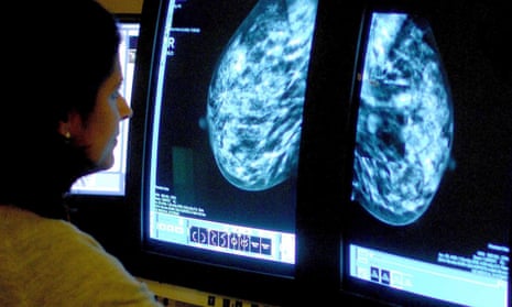 Consultant analysing a mammogram