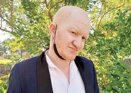 Young Muhamba, president of the Association of Persons with Albinism in Malawi