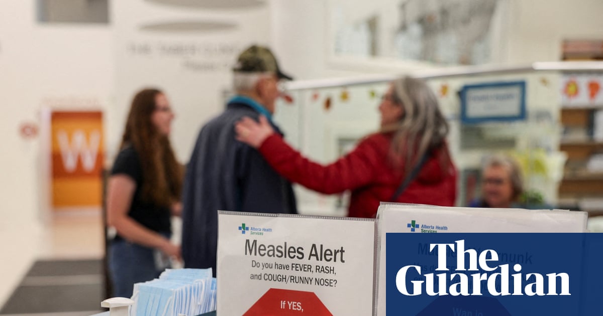 Canada no longer measles-free as outbreaks spread
