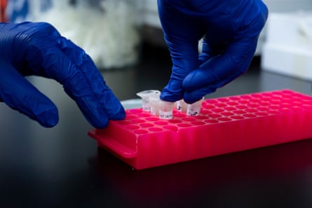 A gloved person arranges blood samples in a tray.