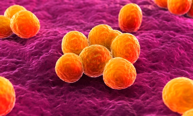 A computer-gnerated image of MRSA bacteria. DNA sequencing for drug-resistant infections first came to the fore during an MRSA outbreak in Cambridge.