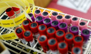 Blood samples donated by recovered coronavirus patients for plasma extraction