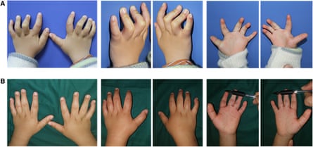 a composite image of hands