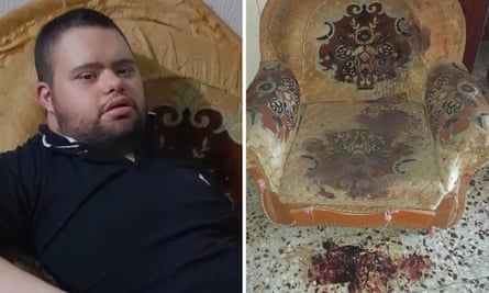 Two images side by side show a young man with Down’s syndrome sits in a chair and the same chair, unoccupied, but with heavy red staining.