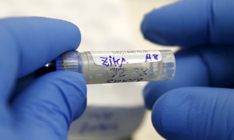 Scientists are still investigating how long the Zika virus can be traced in saliva