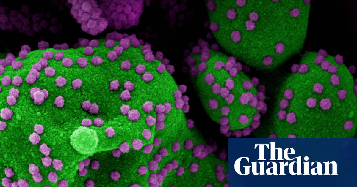 Study into gene that affects Covid severity should be treated with caution
