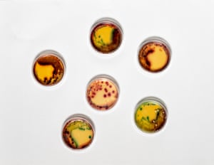 Faecal sample from Australia Sea Lions (Neophoca cinerea) that has been plated on Chromacult media - a selective differential media that makes E. coli visible by showing it as dark purple.