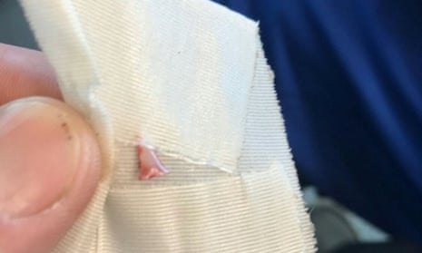 An official from the Ocean Beach fire department said a tooth extracted from the leg of one of the victims ‘looks like a shark’s tooth’. 