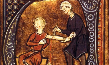 Interest rate rise will be as useful as medieval bloodletting | Letter