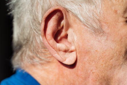 'Meu pai, de 80 anos, reclama que seus aparelhos auditivos o fazem parecer um homem velho e raramente os usa.'