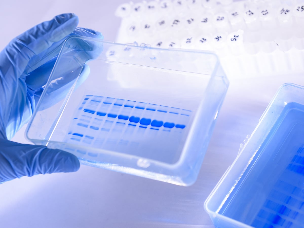 Uk Scientists Enrol Volunteers For Coronavirus Vaccine Trial World News The Guardian