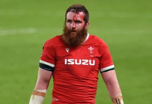 A bloodied and dejected looking Jake Ball of Wales at full time.