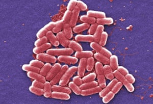 E coli bacteria