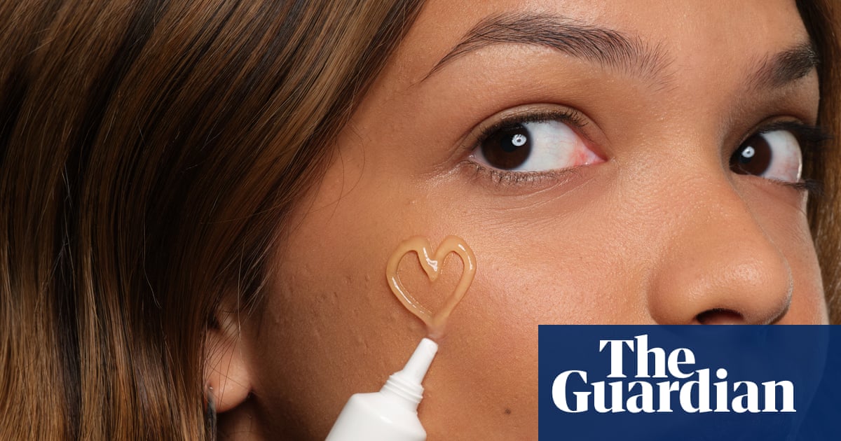 Sali Hughes on beauty: forget harsh treatments – to get rid of adult acne, show your skin some love
