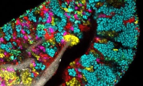 A human tongue with each colour representing a different type of microbe.