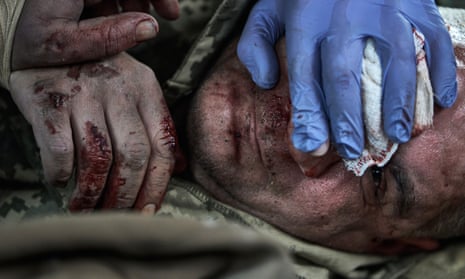 یک سرباز اوکراینی مجروح در 1 نوامبر 2023 در کوپیانسک اوکراین در بحبوحه جنگ روسیه و اوکراین تحت درمان قرار گرفت.