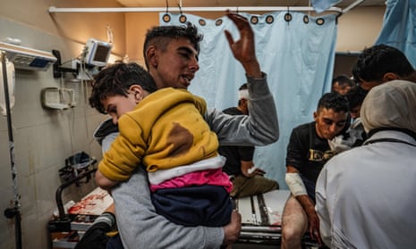 Palestinians wounded in Israeli attacks, including children, at Nasser hospital in Khan Younis on Monday.