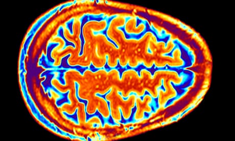 A coloured magnetic resonance imaging (MRI) scan of an axial section through a healthy brain