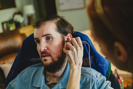 A woman uses a small stimulating device on a man’s head