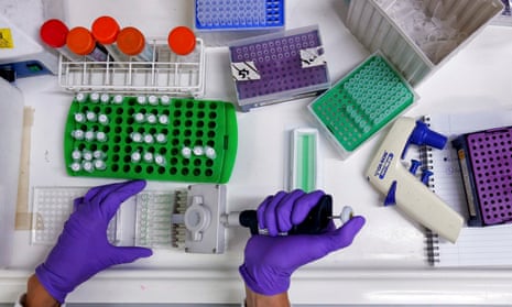 A scientist prepares protein samples for analysis at the Institute of Cancer Research in Sutton, Surrey. 