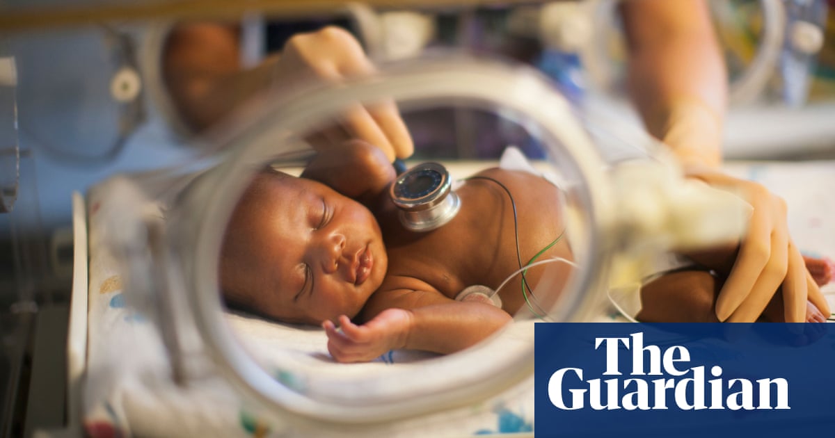 Tests to assess newborns health not effective for BAME babies in UK