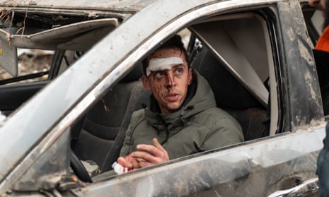 Injured man in his car wrecked by a Russian missile strike on a residential apartment building in Kharkiv, Ukraine